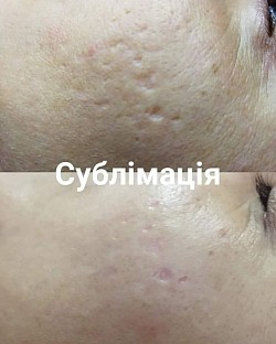 Шліфовка постакне